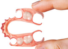partial-dentures-222x160